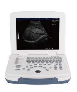 Ultrasound Portable Black and 
White MAS-580
