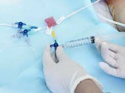 ureteral catheter