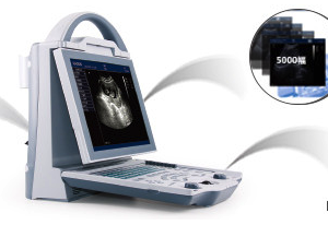 Alternative view of KX5600 Human Diagnostic Ultrasound