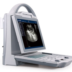 KX5600 Human Diagnostic Ultrasound