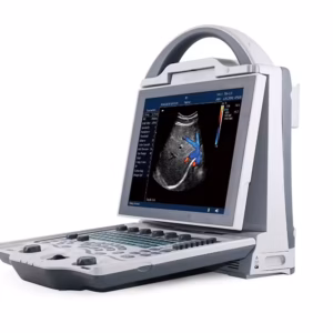 Alternative view of DCU12 Full Digital Color Doppler Ultrasound scanner(Human)