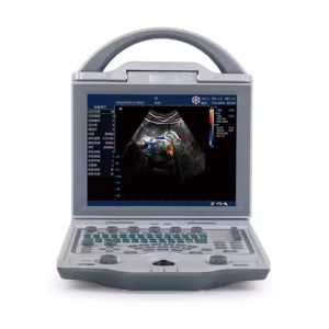 DCU12 Full Digital Color Doppler Ultrasound scanner(Human)