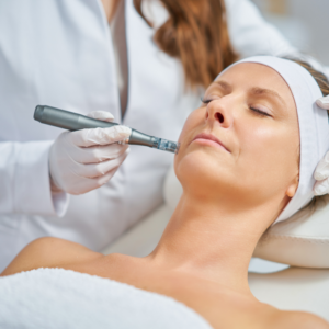 Alternative view of Microneedling Training | One-on-one