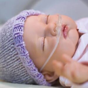 Alternative view of Neonatal Nasal Cannula