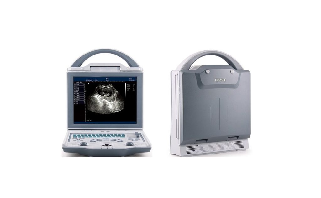 Rechargeable Human Ultrasound Scanner -KX5600 - Image 2
