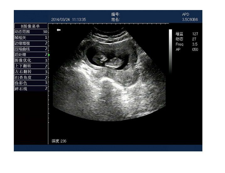Rechargeable Human Ultrasound Scanner -KX5600 - Image 7