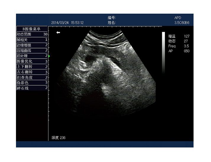 Rechargeable Human Ultrasound Scanner -KX5600 - Image 8