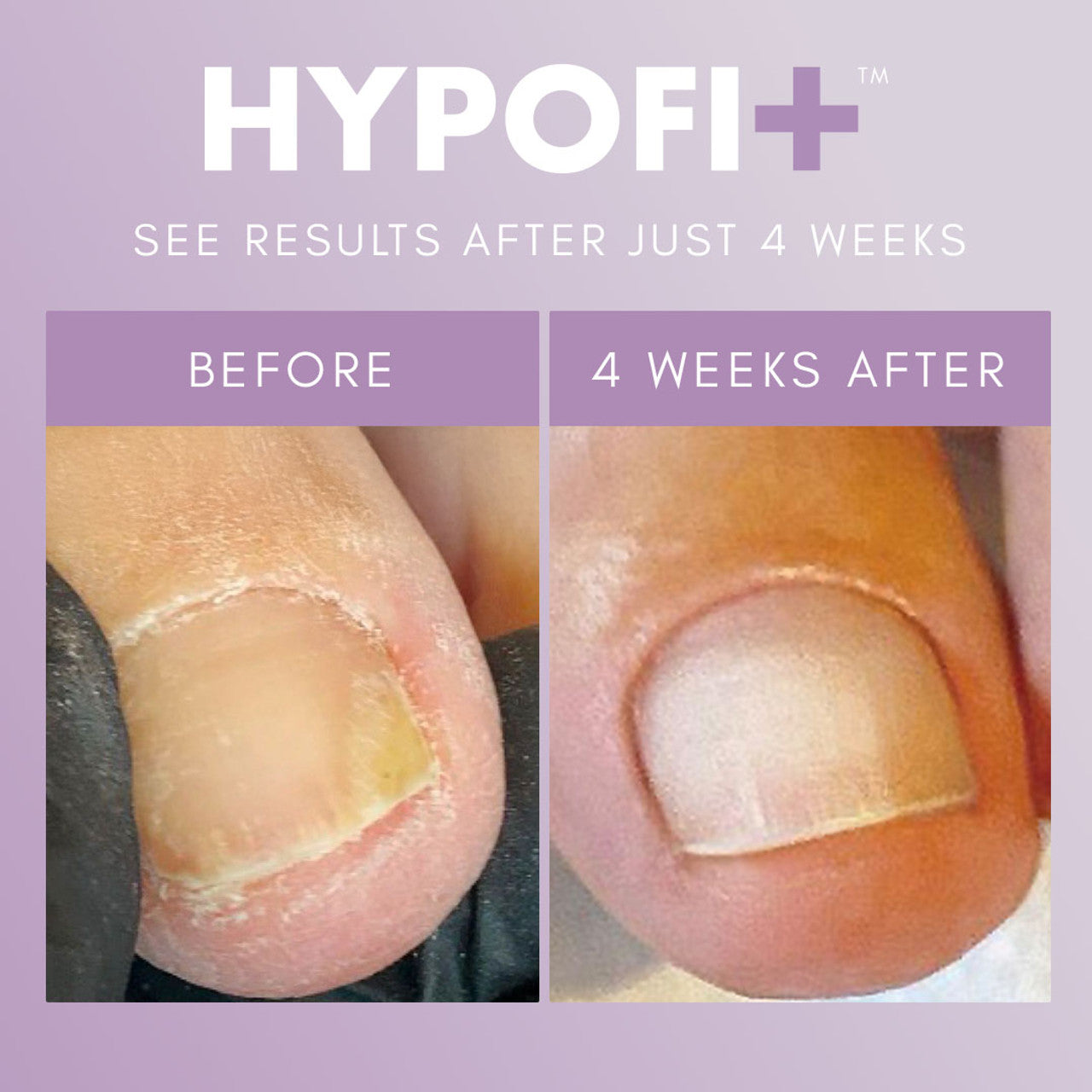 Alternative view of HypoFix Repair Serum 20ML
