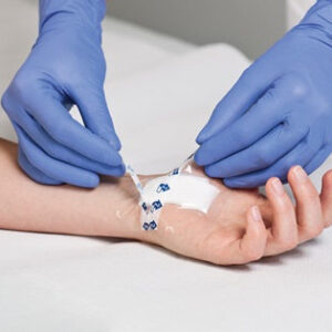 Alternative view of Hydrofilm Plus Transparent Film Dressing with Absorbent Pad
