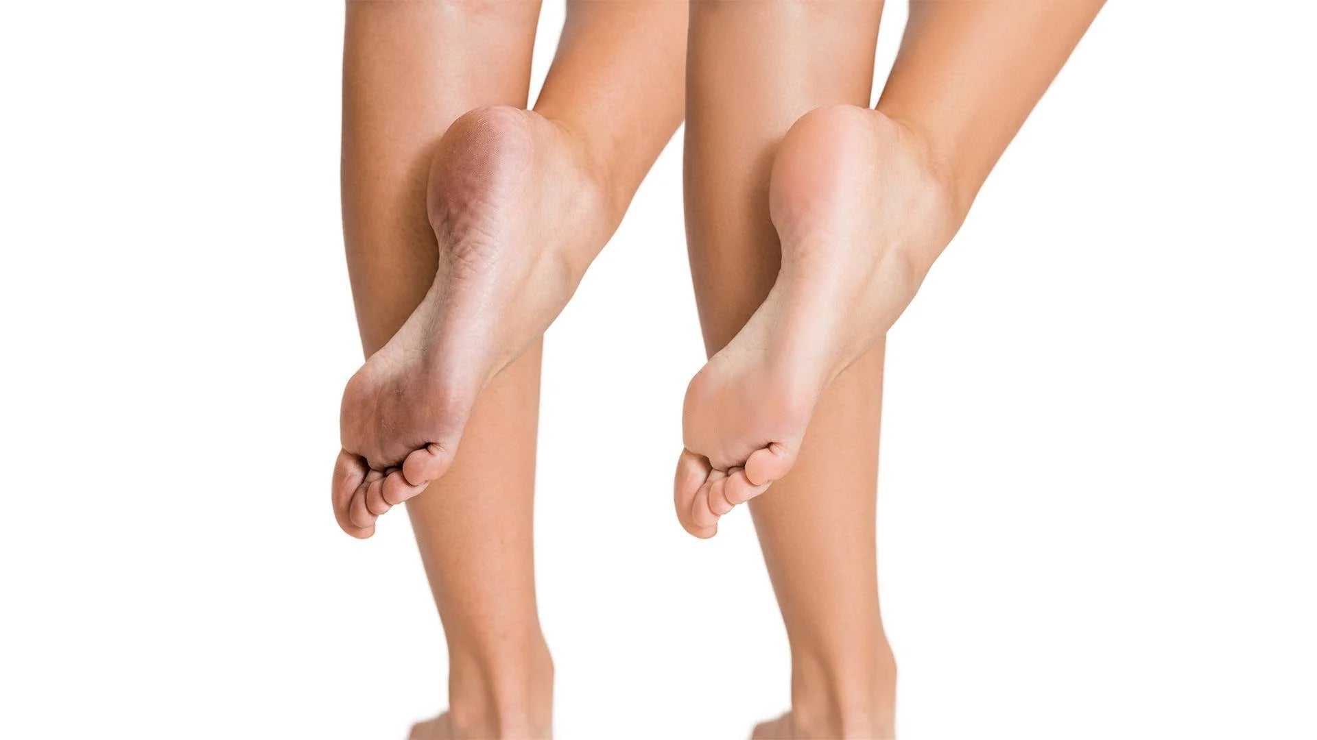 i-Spa Heel Peel Online Course - Image 3
