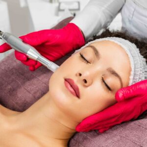 Alternative view of Microneedling - Correspondence course with kit