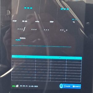 vital signs monitor-E8 8 inch monitor