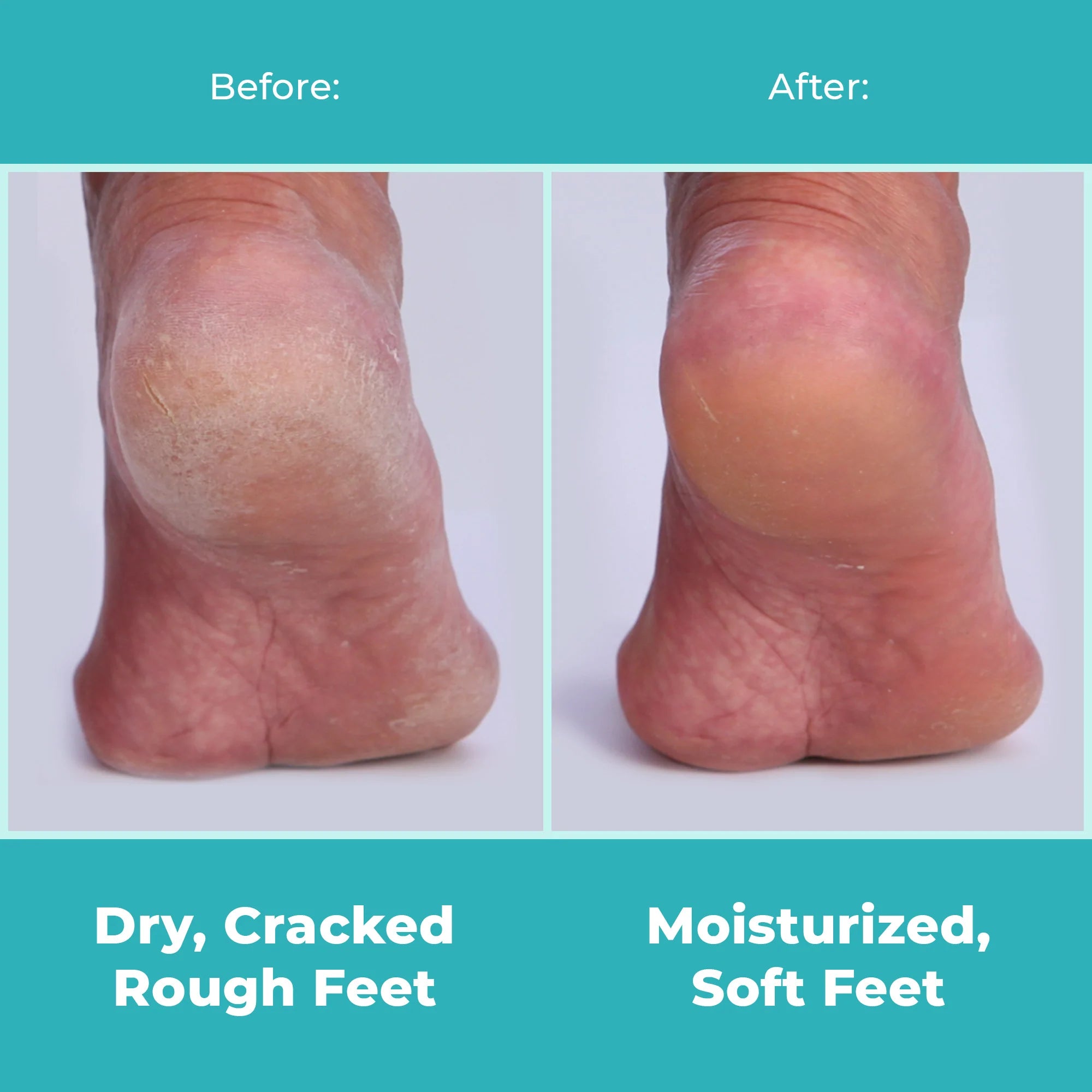 i-Spa Heel Peel Online Course - Image 4