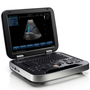 Portable Ultrasound Scanner  15-inch LED display MAS-15L