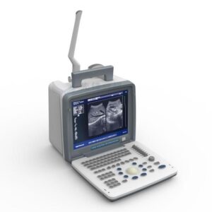 Alternative view of Portable LED screen ultrasound